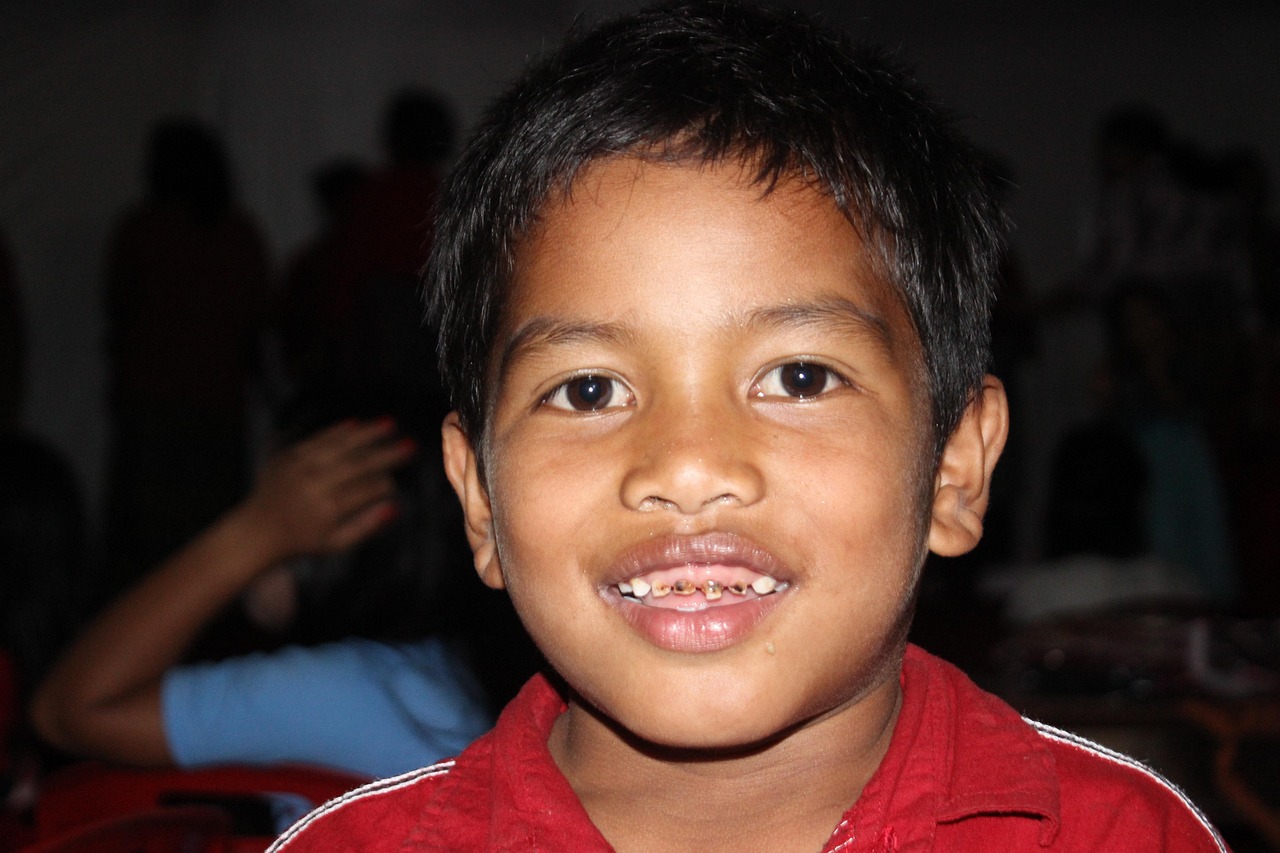 After smile makeover